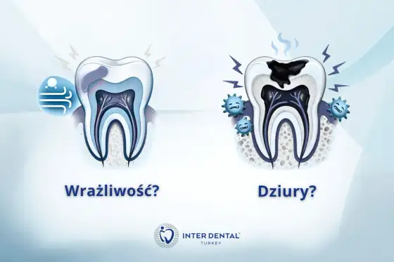 Nadwrażliwość zębów - co stosować i kiedy iść do dentysty