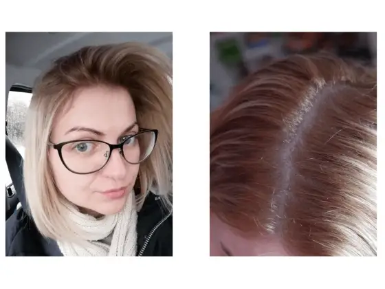 Ciepły blond bez żółtego efektu - odcienie i pielęgnacja